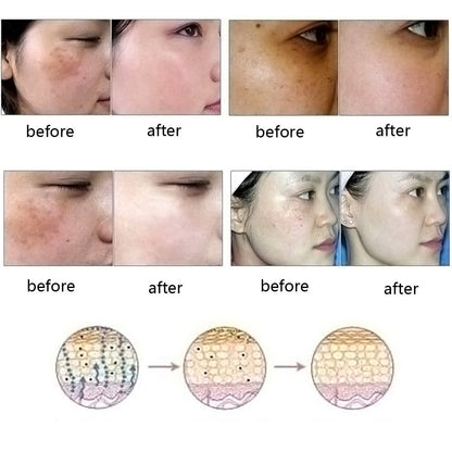 Acne & Scar Removal Essence