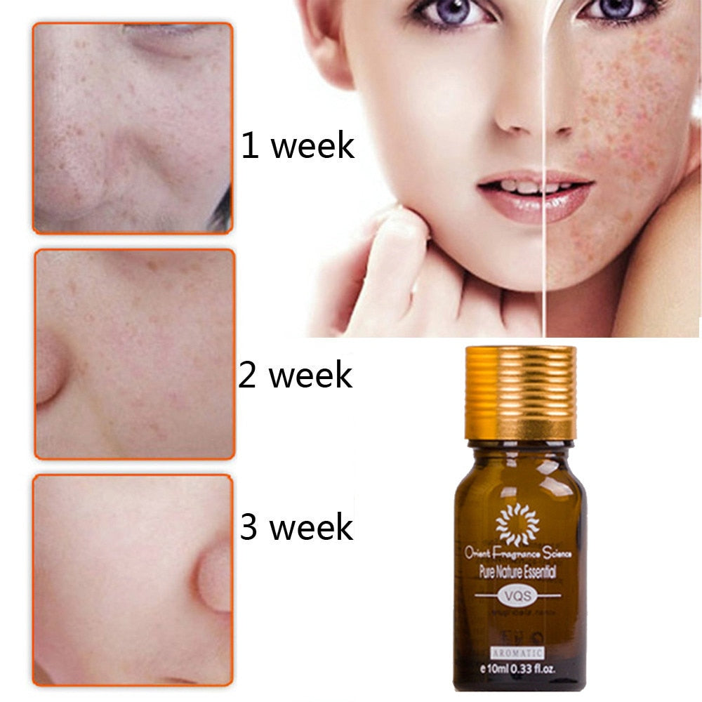 Acne & Scar Removal Essence