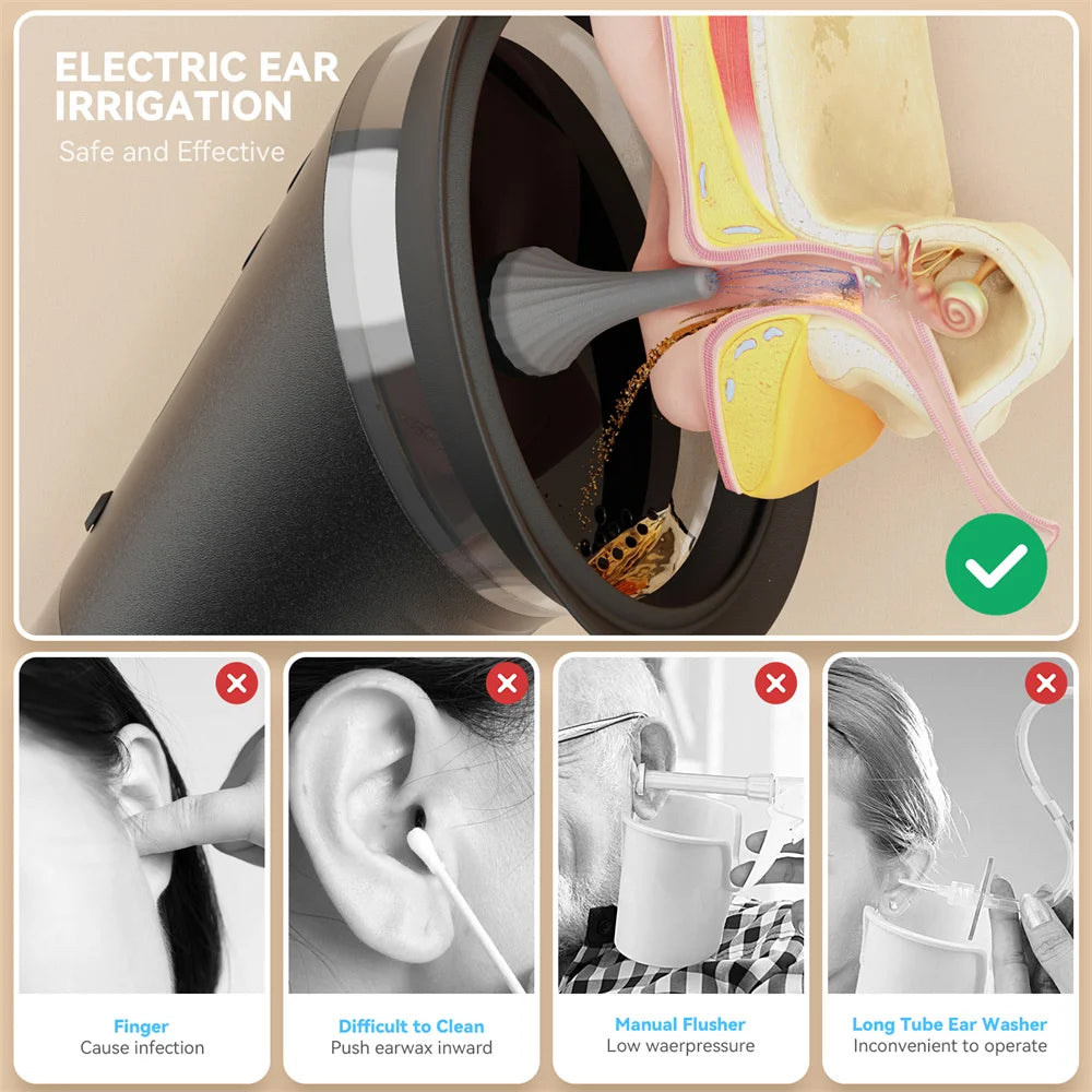 Electric Ear Wax Remover